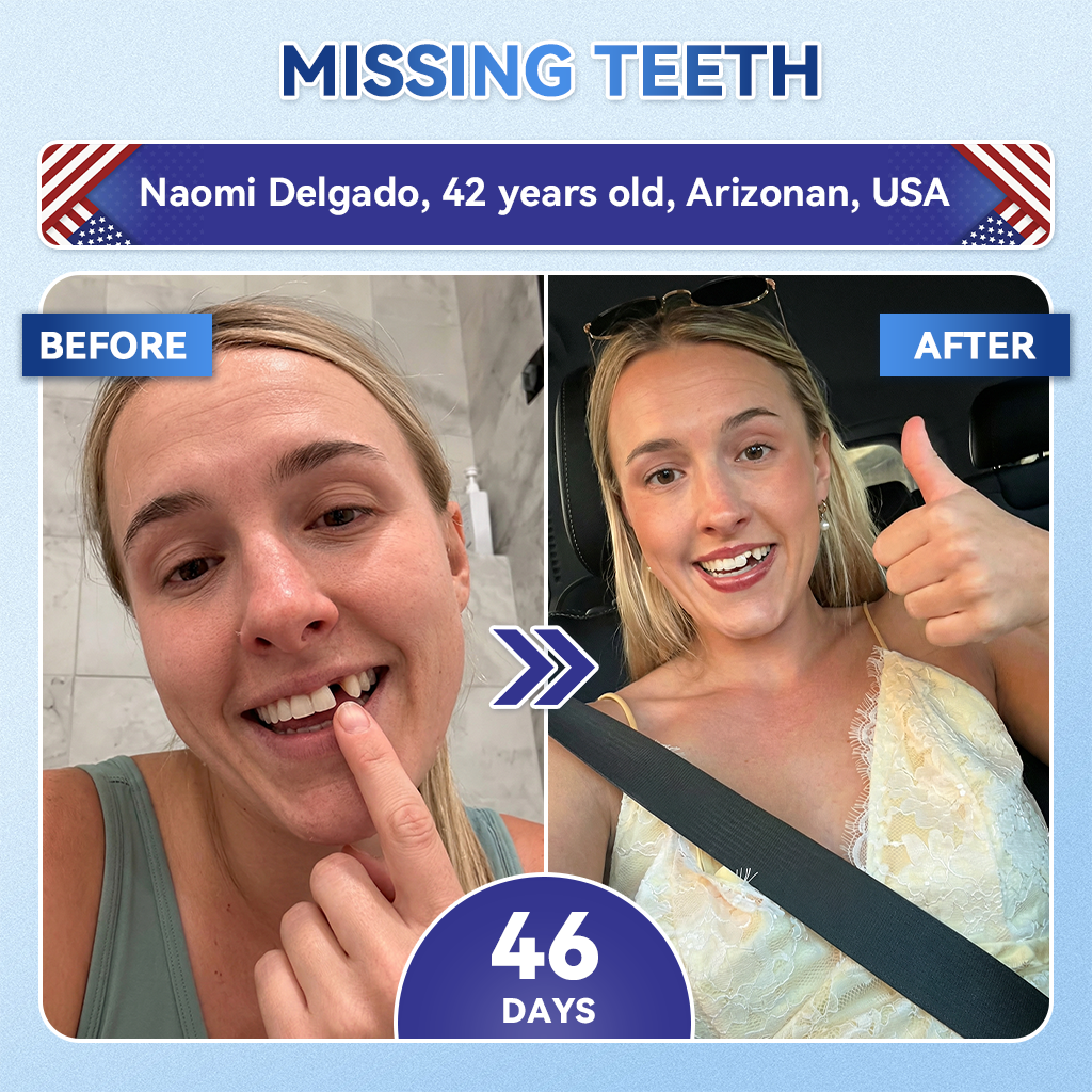 Your Smile~ NESLEMYยฎ ๐ฆท Tideglusib FastโDissolving Tooth & Gum Repair Oral Strips โจ (๐-๐ข๐ง-๐ ๐ ๐๐๐๐ฎ๐ข๐ฅ๐ ๐๐ง๐๐ฆ๐๐ฅ & ๐๐๐ง๐ญ๐ข๐ง โข ๐๐ญ๐ซ๐๐ง๐ ๐ญ๐ก๐๐ง ๐๐ฎ๐ฆ๐ฌ โข ๐๐ซ๐๐๐ข๐๐๐ญ๐ ๐๐๐ซ๐ญ๐๐ซ & ๐๐๐จ๐ซ โข ๐๐ก๐ข๐ญ๐๐ง๐ข๐ง๐ โข ๐๐ญ๐จ๐ฉ ๐๐จ๐จ๐ญ๐ก ๐๐๐ง๐ฌ๐ข๐ญ๐ข๐ฏ๐ข๐ญ๐ฒ)